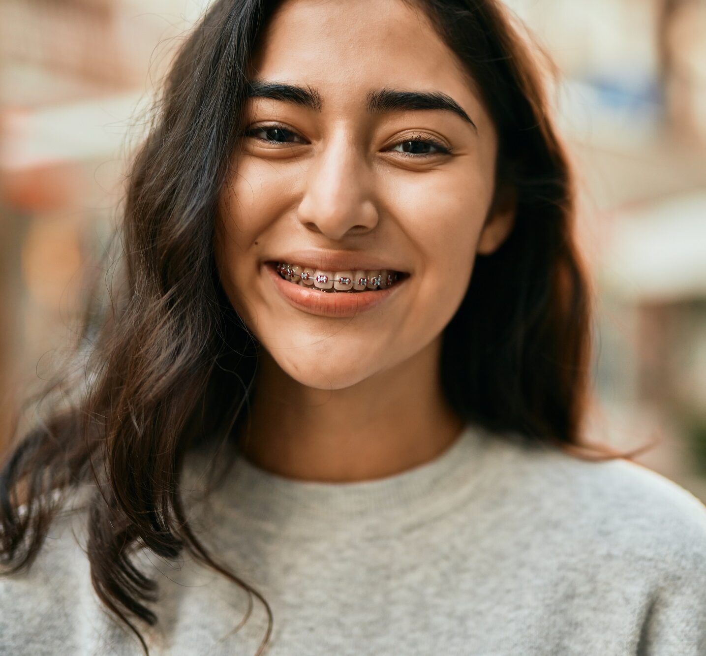 Young Woman with Braces - Ultra Dental A smiling young woman outdoors proudly showing her braces - Ultra Dental.