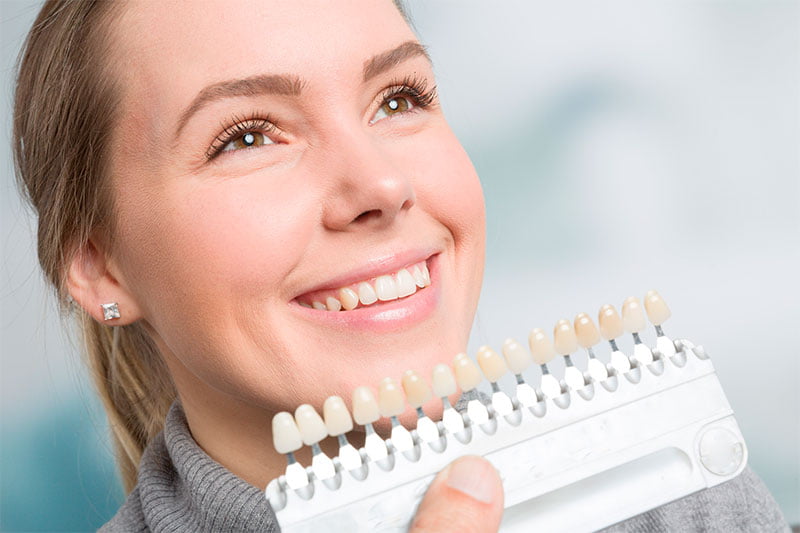 Dental Veneers In San Fernando, CA