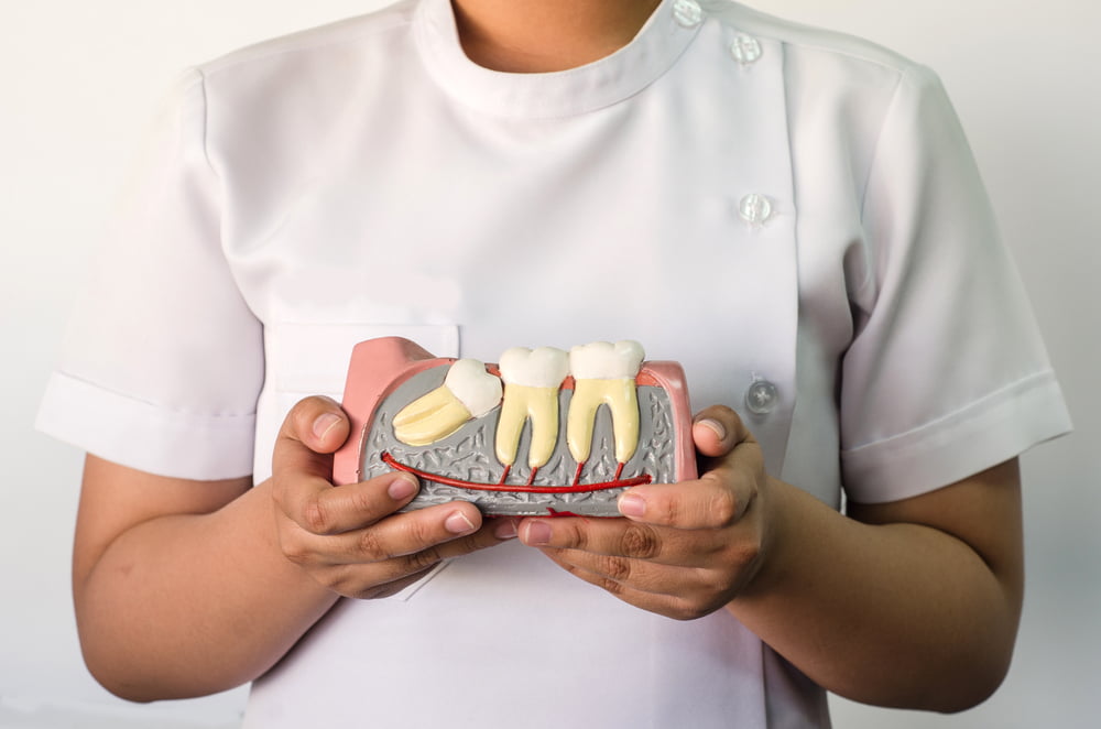 Impacted Wisdom Teeth: Understanding the Risks and Why Removal Might Be Necessary
