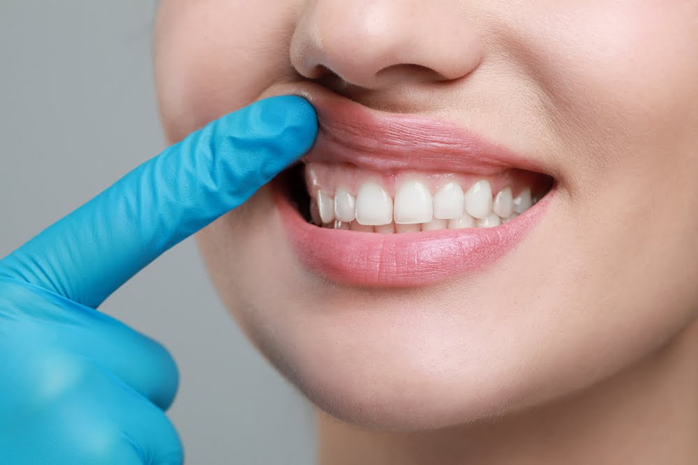 Scaling and Root Planing: A Deep Dive Into Non-Surgical Gum Disease Treatment