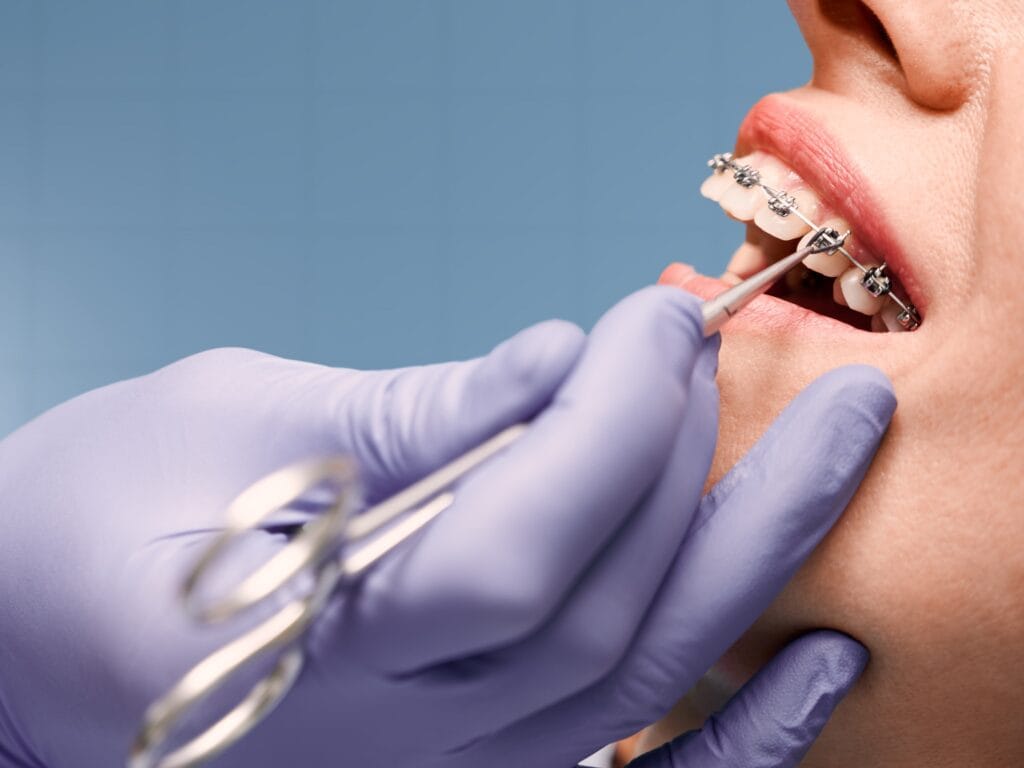 What is an Orthodontist? Understanding Your Smile Specialist