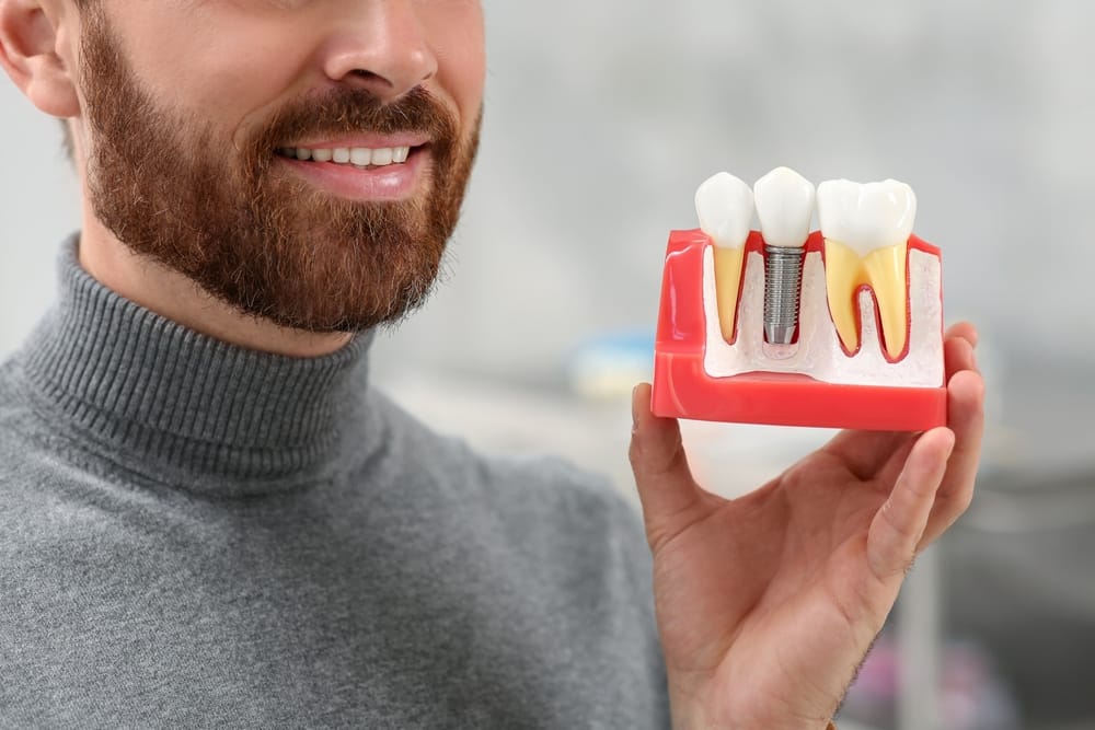 A smiling man holds a detailed dental implant model, demonstrating how implants restore missing teeth with strength and stability – Dental Implants in San Fernando, CA.